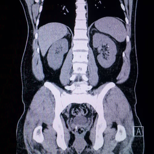 expertise-why solving real human problems win-showing up in AI overview is not the same as getting traffic from chatGPT- phl wiseman _analytics that profit